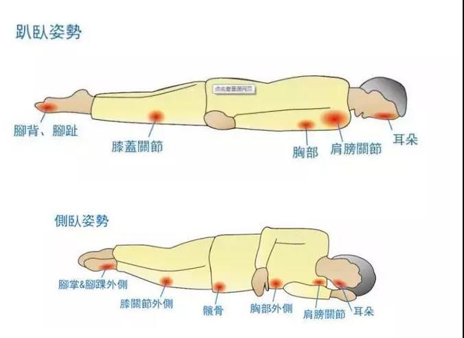 八旬奶奶屁股烂成了"火山口!久卧在床,如何预防褥疮(必须收藏)