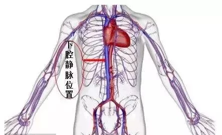 女性盆腔静脉图片