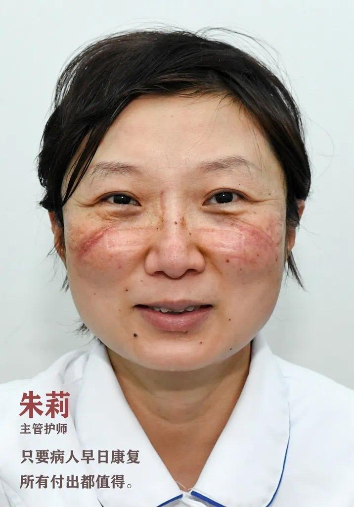 抗疫护士的脸图片