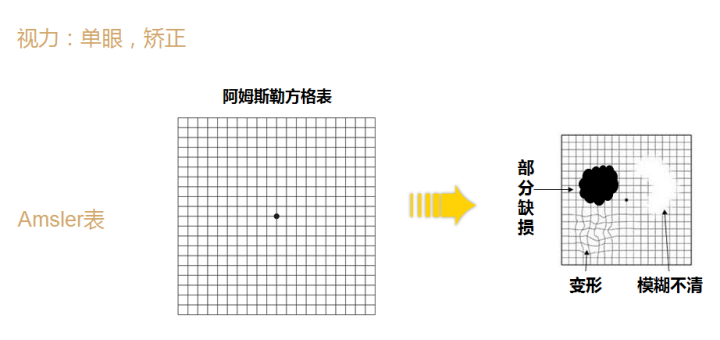 筛查,诊疗,随访患者管理做好三部曲阿姆斯勒方格表仅是一种辅助性的